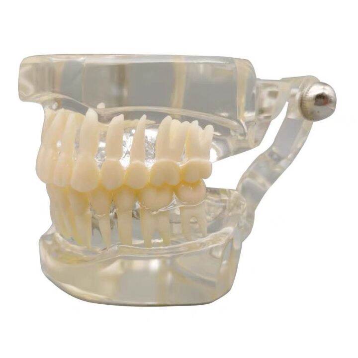 Dental oral teaching model standard tooth transparent crystal model