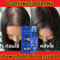 ?บอกลาหัวล้าน?สเปรย์ปลูกผม เร่งผมขึ้นใหม่ เร่งผมยาวไว ป้องกันผมร่วง ป้องกันผมร่วงอย่างมืออาชีพ แก้ปัญหาผมร่วง ลดผมร่วง(น้ำยาใส่ผม ยาปลูกผม น้ำยาปลูกผม น้ำยาเร่งผมยาว เซรั่มปลูกผม ปลูกผมเร่งด่วน ปลูกผม ยาปลูกผมของแท้ ยาปลูกผมผู้ชาย)Hair Growth