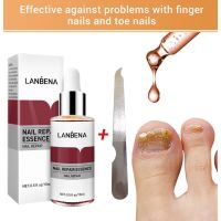 LANBENA Nail Fungal Treatment Anti Fungus Toenail Fingernail Nails Repair Car Onychomycosis Repair Liquid Thicken Soft Nails Brighten Repair Nourish Toenail nail repair essence with small file BEAUTYSECRET