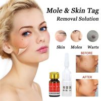 mandarins-Mole Skin Removal Solution Cream Oil Removal Solution + Repair Solution Skin Care Mole Removal Face Dark Spot