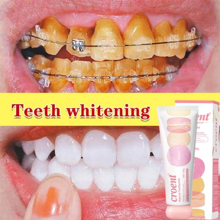 Fruit Toothpaste 100g to remove stone permanent teeth whitening toothpaste multicare formula