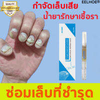 【สูตรใหม่】EELHOE Nail Repair Essence Serum เซรั่มบำรุงเล็บ ป้องกันเชื้อรา แก้ไขปัญหา​เล็บ​หนาที่ก่อตัวนานจากเชื้อรา เซรั่มซ่อมเซมเล็บ