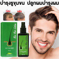 Neo Hair Lotion นีโอแฮร์ของแท้ ยาปลูกผม ยาปลูกผม นีโอ แฮร์ โลชั่น นีโอแฮร์ เซรั่มบำรุงผม แก้ปัญหาผมร่วง เร่งการเจริญเติบโตของเส้นผม ยาปลูกผมหญิง นีโอแฮร์โลชั่น 120ml