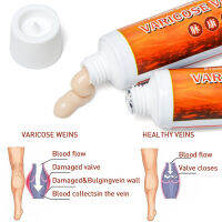 Sumifun เส้นเลือดขอดรักษาครีม varicosity angiitis Remedy ครีมบรรเทาเส้นเลือดปวด phlebitis ขาร่วมครีม