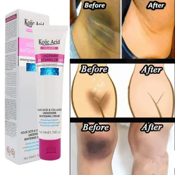 Permanent Skin Whitening Cream Best Price in Singapore May