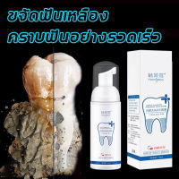 มูสแปรงฟัน 60ml ฟอกฟันขาว ขจัดคราบหินปูน ยาสีฟันไวท์เทนนิ่ง ยาสีฟันฟันขาว การฟอกสีฟัน ฟอกสีฟัน ดูแ