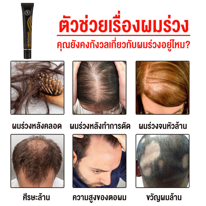 ยาปลูกผมผู้ชาย-เร่งผมยาว-ลูกกลิ้งนวด-ซึบซาบเร็วขึ้น-ปรับปรุงคุณภาพของเส้นผม-น้ำยาปลูกผม-เซรั่มปลูกผม-ลดผมร่วง-ปลูกผม-ฟื้นฟูผมแห้งเสีย-ทรีนเมนบำรุงผม-ยาปลูกผมของแท้-เซรั่มบำรุงผม-hair-growth