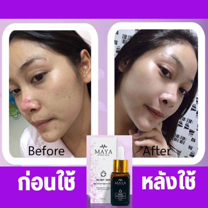 ครีมมายา-มายาเซรั่ม-ญุี่ปุ่น-รักษา-ฝ้า-กระ-ริ้วรอย-7วัน-maya-secert-skin-มายา