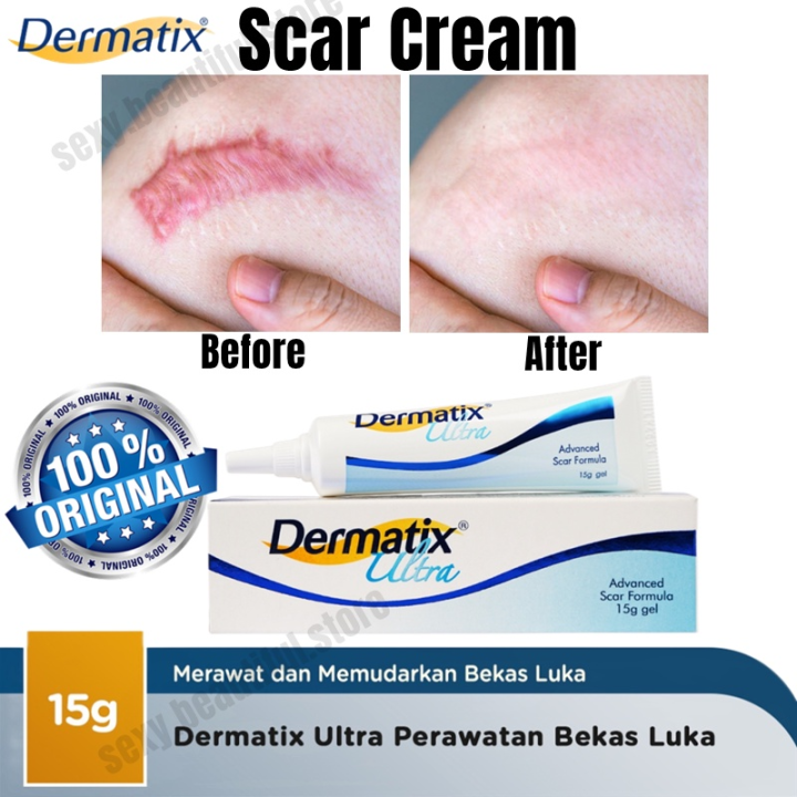 Dermatx Ultra Gel 15g is a repair gel for scars, scars, scars, surgical scars, scald, scar cream