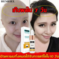 HEMEIEL  บำรุงผมยาวเร็ว/เร่งผมขึ้นใหม่ เร่งผมยาวน้ำยาปลูกผมหนา /hair serum/นีโอแฮร์ของแท้/ น้ำยาปลูกผมชาย