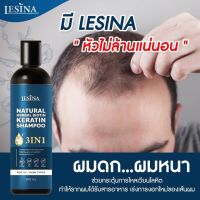 LESINA Natural Herbal Biotin Keratin Shampoo 3in1 400ml.แชมพูสูตรสมุนไพรสารสกัดนำเข้า เกรดพรีเมี่ยม ดูแลทุกปัญหาหนังศรีษะและเส้นผม