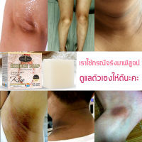 สบู่ไวท์เทนนิ่ง สบู่ข้าวขาว 100g สบู่เร่งผิวขาว ครีมรักแร้ดำ ครีมขาหนีบดำ สบู่ล้างหน้า สบู่ไวท์เทนนิ่ง  เร่งผิวขาว สบู่ไวท์เทนนิ่ง