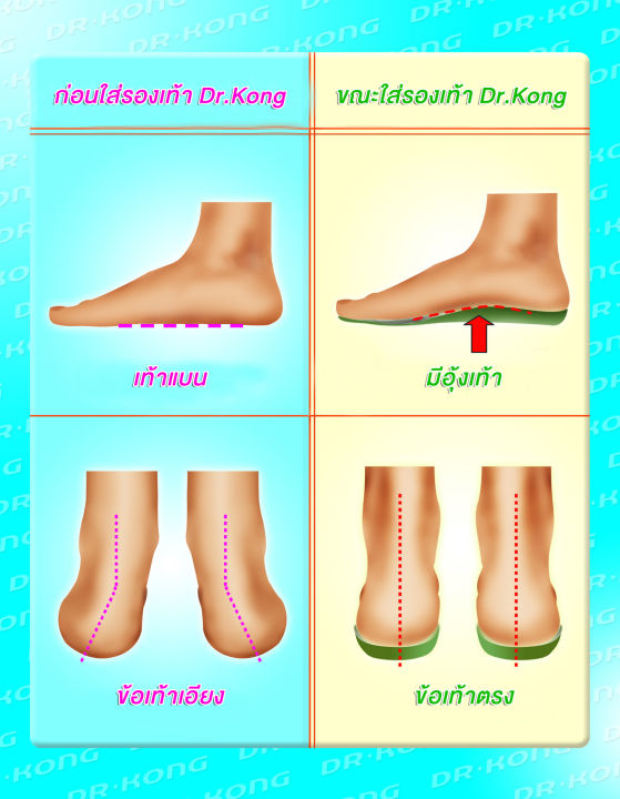 dr-kong-รองเท้าเด็ก-รุ่น-b1402987-pkw-รองเท้าเพื่อสุขภาพสำหรับเด็ก-step2