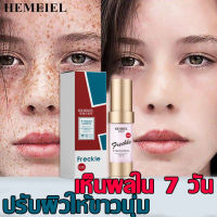 HEMEIEL  ครีมทาฝ้าลึก/ลดเม็ดสีเมลานิน /กำจัดฝ้า กระ/ให้ผิวสวยกลับมา