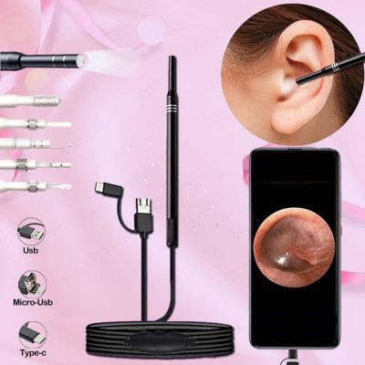 Endoscop Ear Cleaning Earpick Medical Otoscope Bebird Cleaner Ear Sticks Minifit Camera Endoscope Ear Cleaning Wax Removal Tool