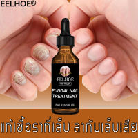 EELHOE เซรั่มซ่อมแซมเล็บ เล็บเชื้อรา 30ml บำรุงเล็บมือ เชื้อราที่เล็บ ยากันเชื่อราเล็บ ชุดแต่งเล็บขบ บำรุงเล็บเสีย อุปกรณ์ทำเล็บ ครีมบำรุงเล็บ ครีบบำรุงเล็บ น้ำมันบำรุงเล็บ น้ำยาซ่อมเล็บเล็บ