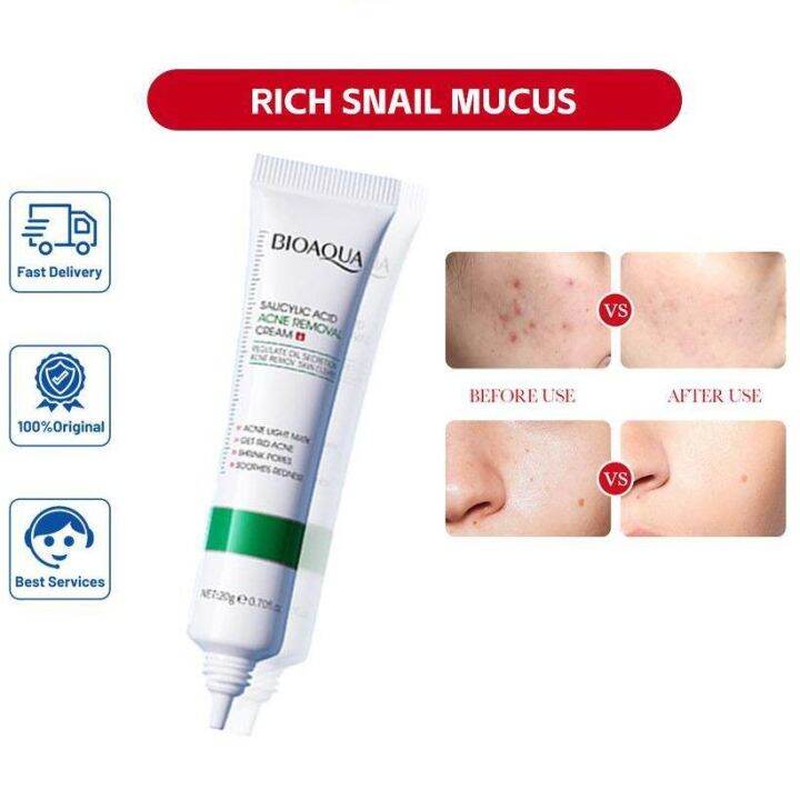 SEVICH Salicylic Acid Acne Remove Acid Acne Cream 20g Blackhead removal