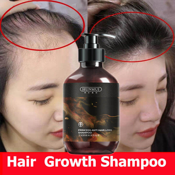Hair Growth Shampoo ยาสระผม 400ml บำรุงให้รากผมแข็งแรง ป้องกันผมร่าง