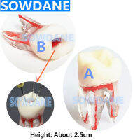 2ชิ้น4ชิ้น1:1เรซิ่นทันตกรรม Endodontic นักเรียนการศึกษาการปฏิบัติการดำเนินงานรุ่นสีรากคลองและเยื่อกระดาษที่ชัดเจนโดยไม่ต้องไฟล์