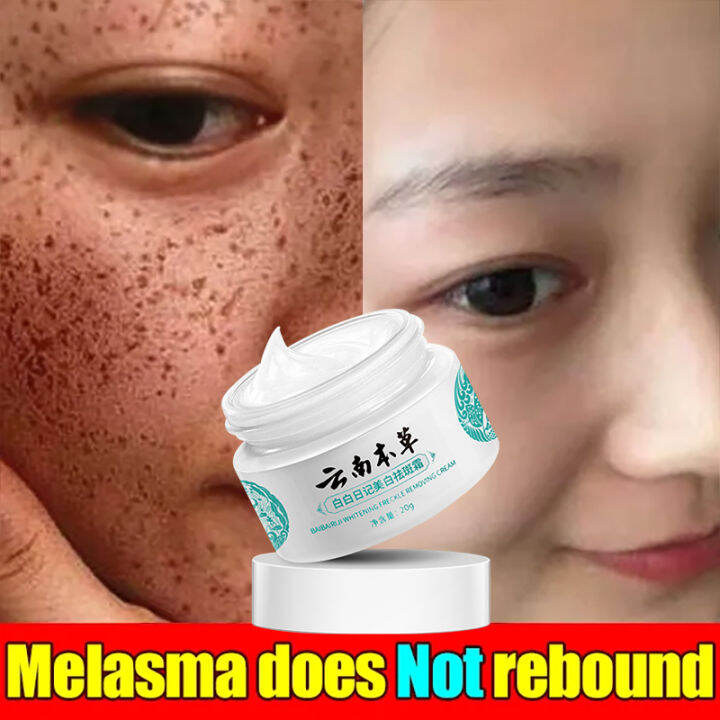 Original Yunnan Herbal Whitening Freckle Cream Japanese Melasma Cream