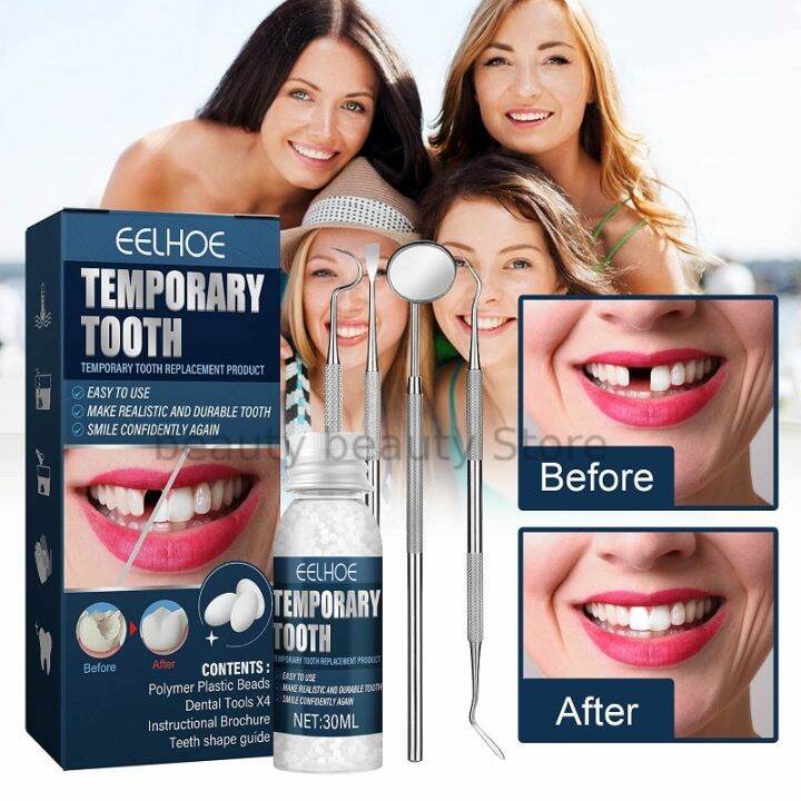 Tooth Filling Glue Set Temporary Tooth Repair Kit False Teeth Solid