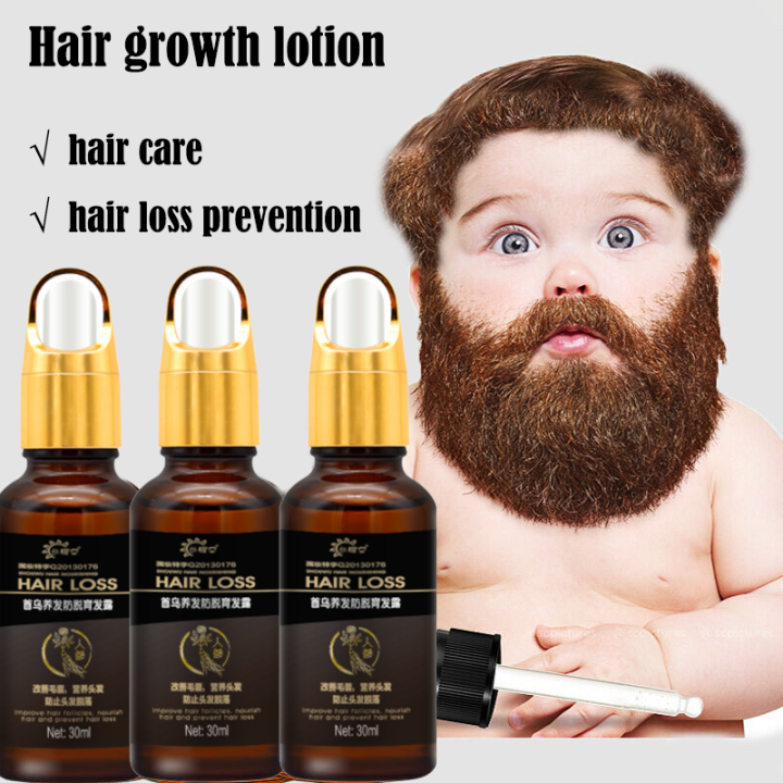 Shouwu hair nourishing anti-hair loss hair growth lotion 30ml herbal ...