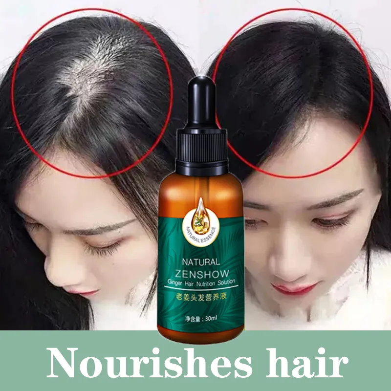 Hair Growth & Anti-Loss Hair Care Serum Ginger Hair Care Oil Hair Loss & Growth Increase Hair Density 30ml Improve Hair Follicles Nourish Hair Roots Hair Oil for Men & Women Soothe Hair Growth & Anti-Loss Hair Care Serum Ginger Hair Care Oil Hair Loss & Growth Increase Hair Density 30ml Improve Hair Follicles Nourish Hair Roots Hair Oil for Men & Women Soothe