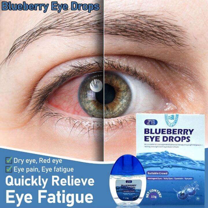 Blueberry Eye Drops Itchy Relieves Dry Eyes Sore Red Eyes Fatigue