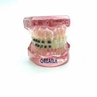 Dental Orthodontic Model With Metal And Ceramic Brackets 3003 Pink Dental School Students Teeth Study Model