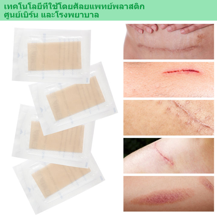 หุ้นที่มีอยู่-แผ่นแปะแผลเป็น-4pcs-ซ่อมแซมรอยแตกลาย-แผลผ่าตัด-แผลผ่าตัดหลังคลอด-สติกเกอร์ความงาม