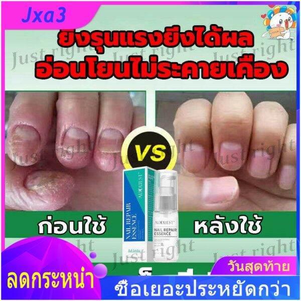 【ตัวช่วยดีๆ ในการฟื้นฟูเล็บ 】AuQuest 20ml ซ่อมเล็บ ซ่อมแซมเล็บ เซรั่มทา