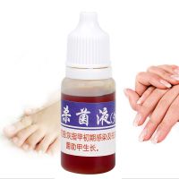 Anti Infection Fungal Nail Treatment Liquid Foot Care Essence Whitening Toe Nail Fungus Removal Gel Paronychia Onychomycosis