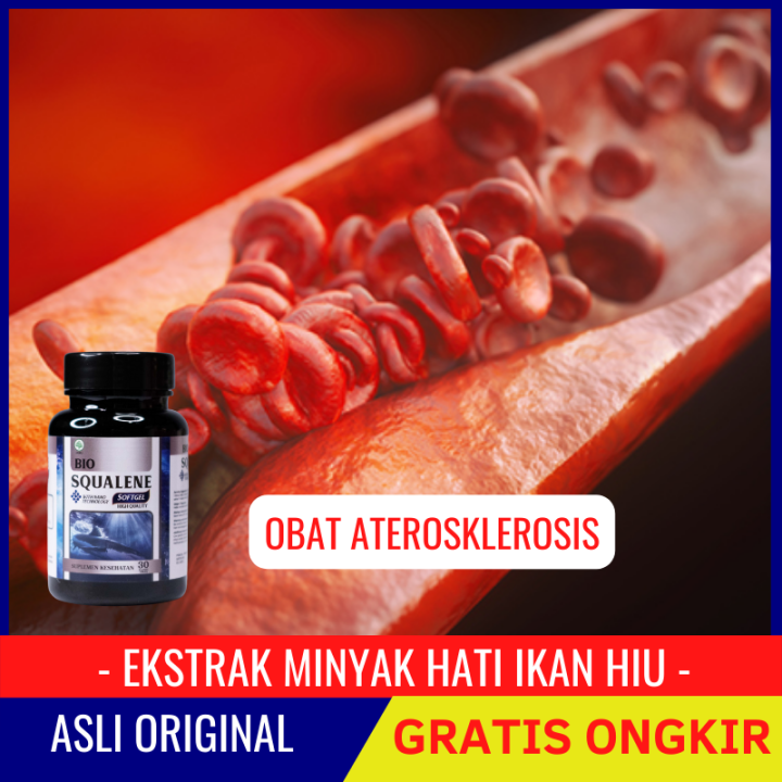 Obat Ateroklerosis Obat Penyempitan Pembuluh Darah Obat Pengencer