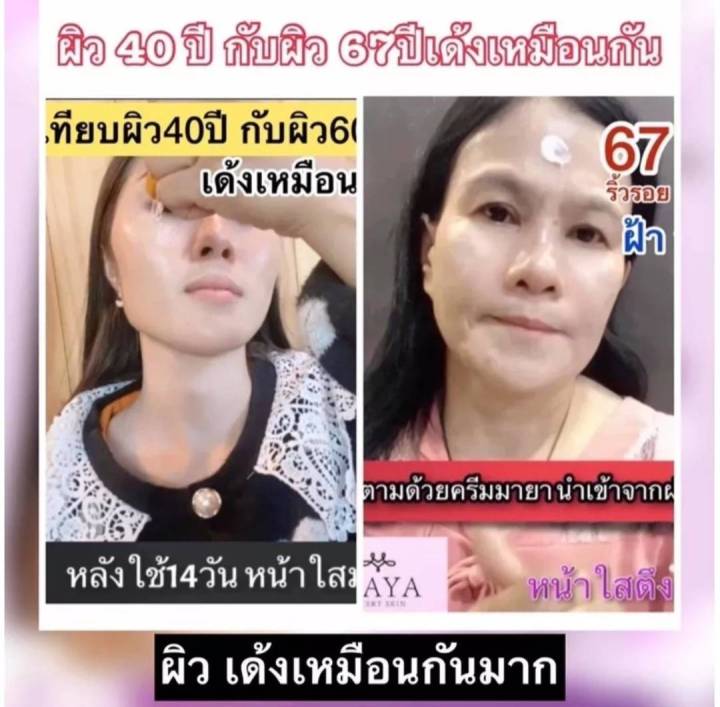 1-แถม-1-mayaเซรั่ม-mayaโบท็อกซ์-เซรั่มมายา-เซรั่มโบท็อกซ์มายา-เซรั่มโบท็อกซ์maya-เซรั่มโบท็อกซ์-mayaโบท็อก