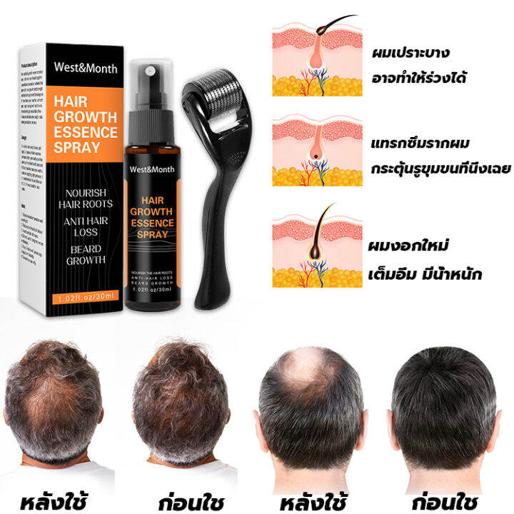 ทำให้ผมยาวขึ้นอย่างรวดเร็ว-สเปรย์ปลูกผม-30ml-ลูกกลิ้ง-ใช้คู่กัน-ได้ผลลัพธ์2เท่า-ป้องกันผมร่วง-ปลูกผมเร่งด่วน-ยาปลูกผม-น้ำยาใส่ผม-เซรั่มปลูกผม-น้ำยาเร่งผมยาว-ปลูกผม-ยาปลูกผมของแท้-hair-growth