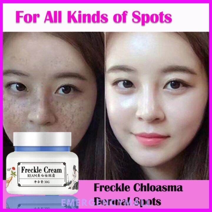 【COD】 Effective Melasma Dark Spot Remover Whipped Face Cream Whitening