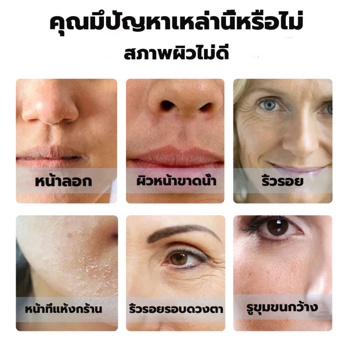 ใหม่-eelhoe-เซรั่มซ่อมแซมผิว-30ml-เซรั่มผิวหน้า-เซรั่มบำรุงผิวหน้า-กระชับหน้า-ทาผิวหน้า-เซรั่มหน้าใส-เอสเซ้นส์-ครีมหน้าเรียว-กระชับใบหน้า-ครีมปรับรูปหน้า-ครีมทากระชับผิวหน้า-ครีมเซรั่มหน้าเรียว-ครีมกร