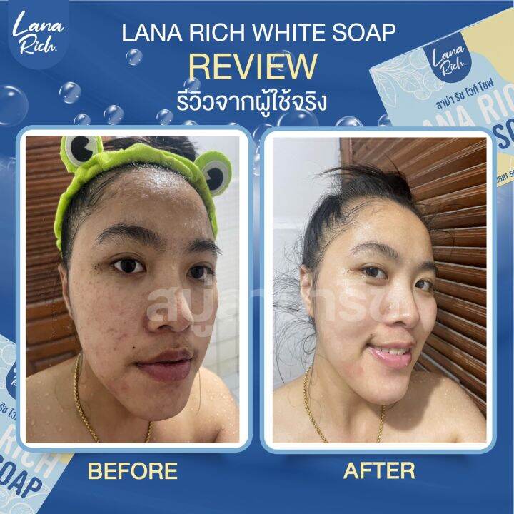 พร้อมส่ง-สบู่ลาน่า-ริช-lana-rich-white-soap-ลา-น่า-ริช-เร่งขาว-ขาวเเรงง-สบู่ผิวตัว-ผสมอาร์บูติน-และ-กลูต้า-ลดรอยแตกลาย