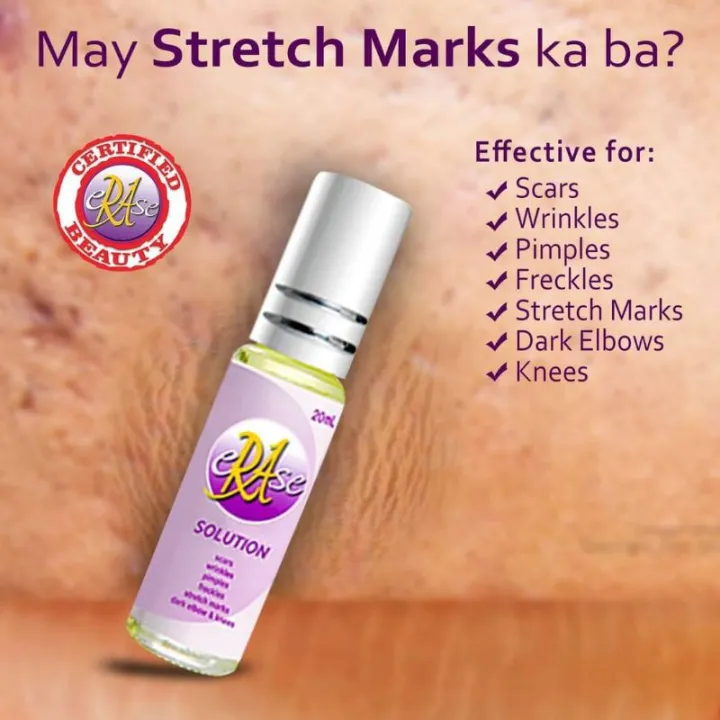 Remove Scars All Types Scar Remover For Old Scar ERASE SOLUTION KOJIC