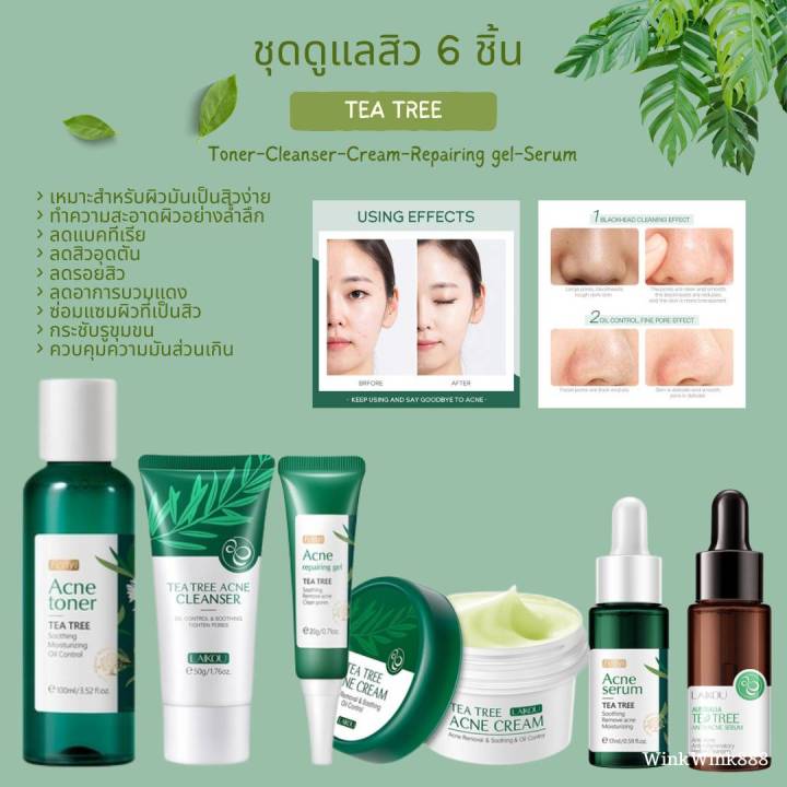 02-ชุดดูแลสิว-6-ชิ้น-สารสกัดจากใบชา-tea-tree-acne-โทนเนอร์-โฟมล้างหน้า-ครีม-เจลแต้มสิว-เซรั่มบำรุง-เซรั่ม