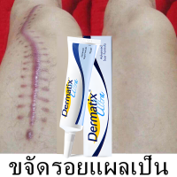 ครีมแผลเป็น เจลซ่อมแซม เจลรอยแผลเป็น รอยแผลเป็น รอยแผลเป็น แผลผ่าตัด น้ำร้อนลวก ครีมทาแผลเป็น ครีม15g