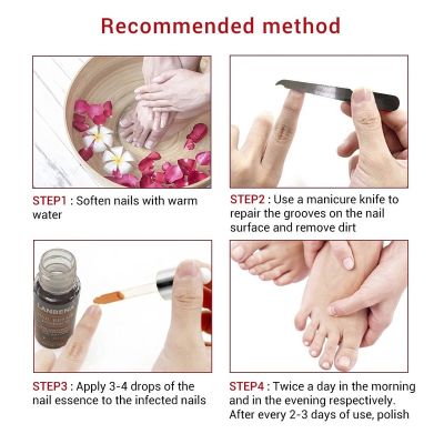 LANBENA Nail Repair Essence Serum Fungal Nail Treatment Remove Onychomycosis Toe Hand Foot Skin Care