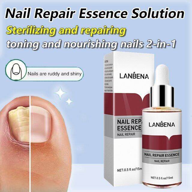 Heartwarming Nail Repair Essence Solution Lazada PH