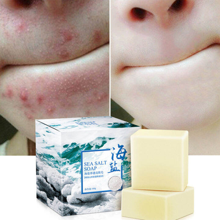 100g/1Box Sea Salt Soap Cleaner Removal Pimple Pores Acne Treatment