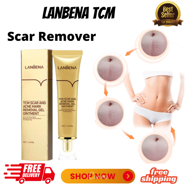 Original Lanbena Tcm Scar And Acne Mark Removal Gel Ointment 30g Effectively Help To Remove 5677