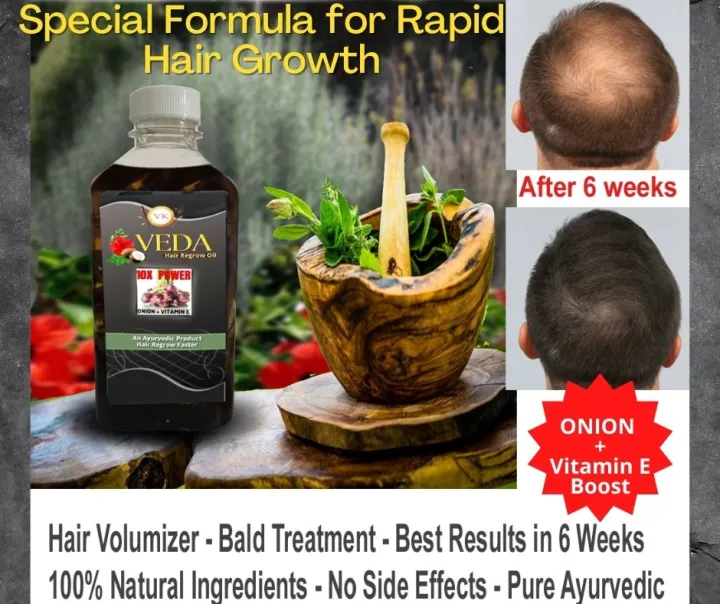 Veda hair regrowth oil Ayurveda hair regrowth liquid for baldness Hair