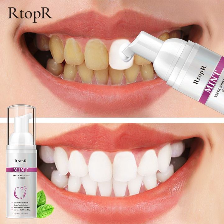 ส่งจากไทย-ยาสีฟันเนื้อมูส-rtopr-teeth-whitening-mousse-60ml-รหัส-85052-สูตรปรับฟันขาว-ขจัดฟันเหลือง-ลดครบหินปูน-ฟันเหลือง