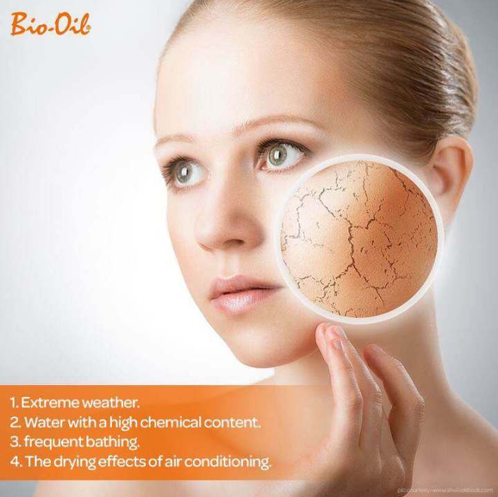 bio-oil-ไบโอออยล์-น้ำมันสกัดบำรุงและรักษาผิวแตกลาย-200-มล