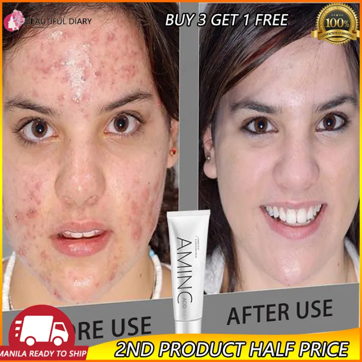 COD【2nd item half price】Facial Foam Cleanser Facial Wash For Women