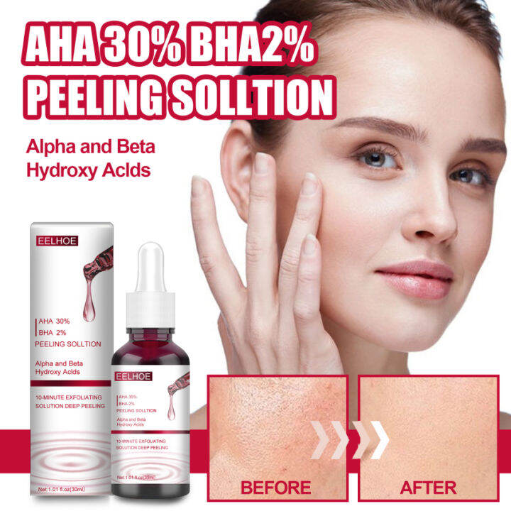 30ml Face Peeling Solution AHA 30 + BHA 2 Salicylic Acid Fruit Acid